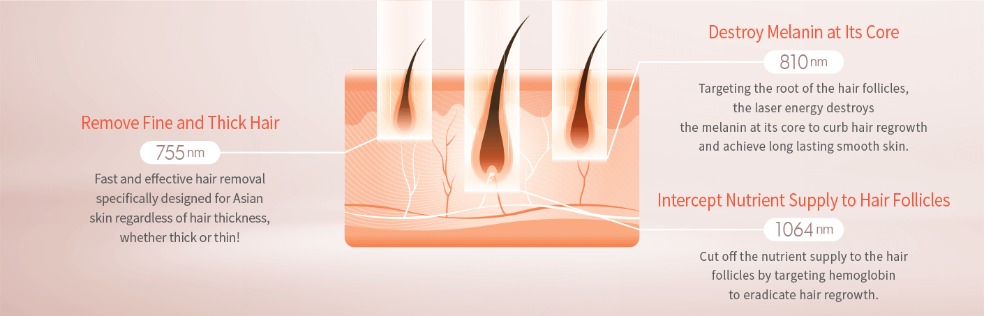 dermes Exclusive Triple Wavelength Laser Hair Removal Technology